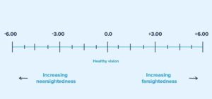 Eye Prescription Chart: Know about sph, cyl, axis in eye prescription