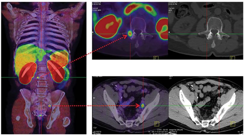 imaging scanning