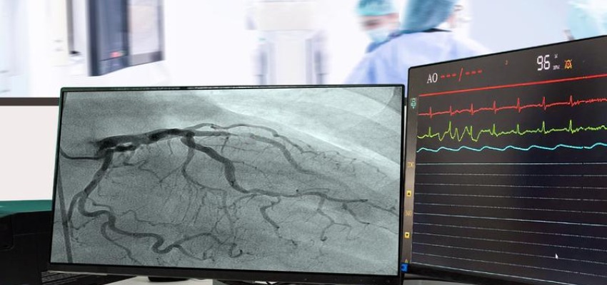 What-is-Angiogram