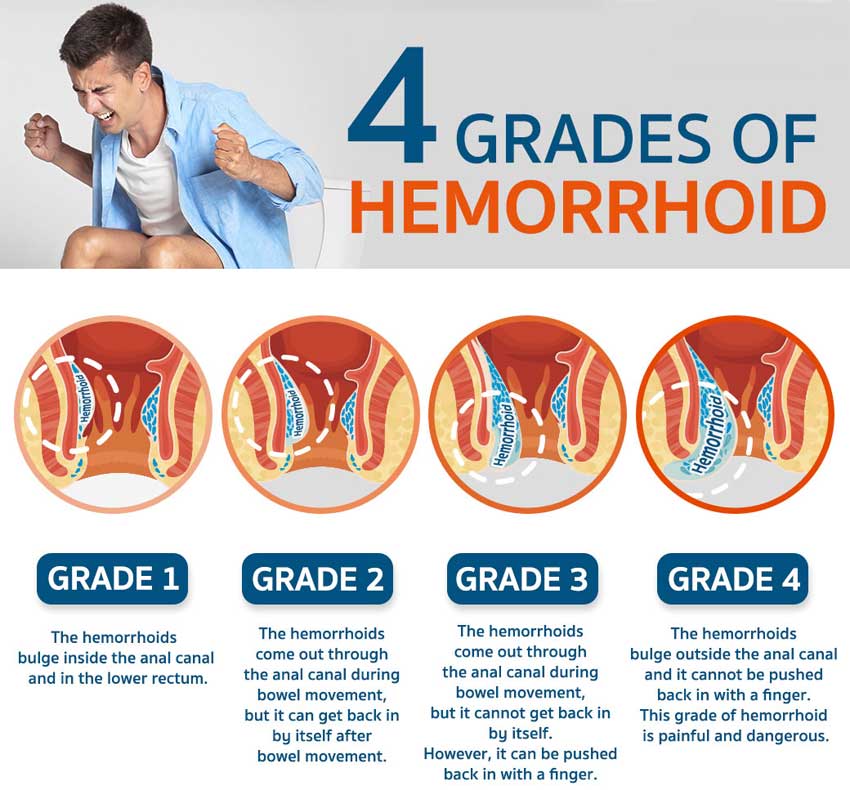 grades of piles and treatment