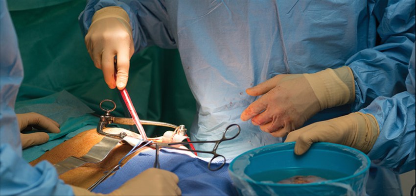 Treatment of kidney transplant