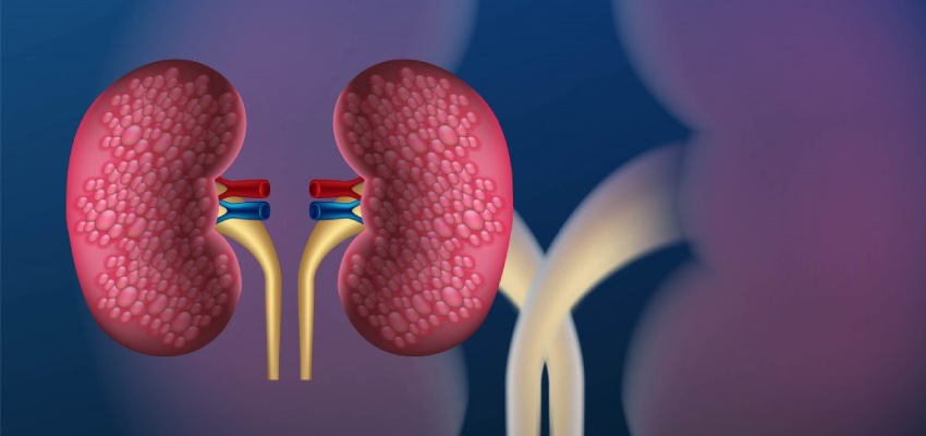 types of kidney transplants