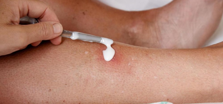 Benefits and Side effects of Fucibet Cream