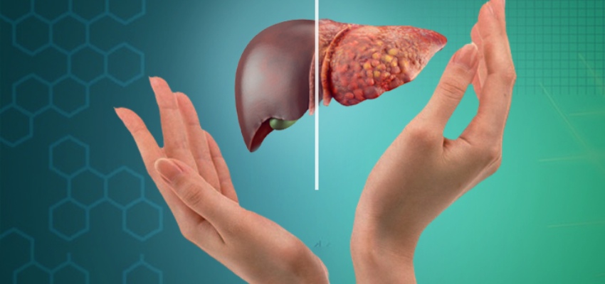 Diagnosis Fatty Liver Disease