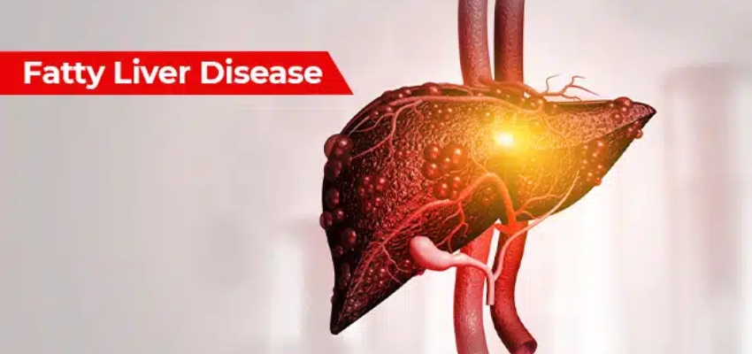 Illness Associated with a Fatty Liver