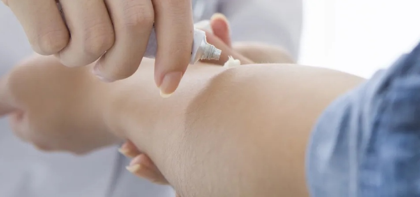 Uses of The best Fucibet Cream