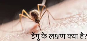 डेंगू के लक्षण क्या है?