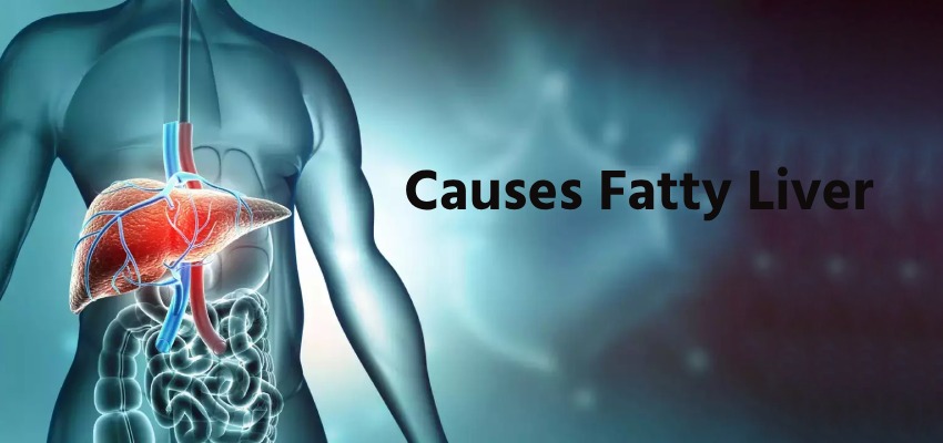 Causes-Fatty-Liver