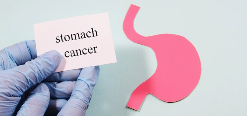 Types-of-stomach-cancer
