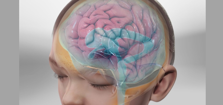 Diagnosis of hydrocephalus