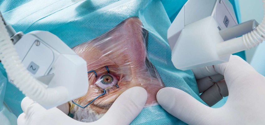 Procedure of cataract surgery