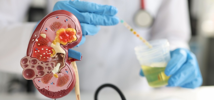 Kidney problems causes and symptoms