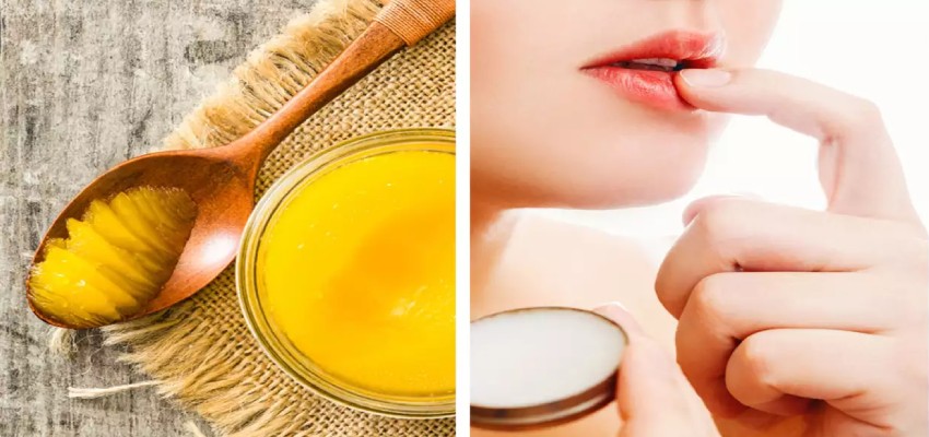 Home remedies to heal chapped lips
