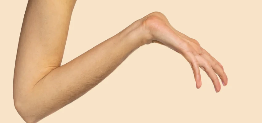 About Marfan Syndrome Treatment