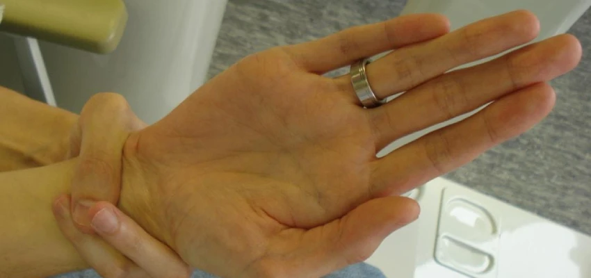 Diagnosis of Marfan syndrome