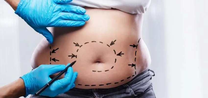 Some main types of liposuction surgery
