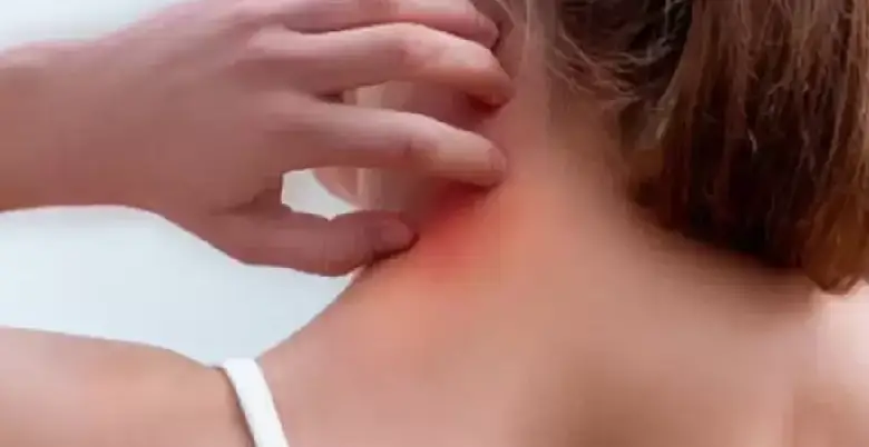 khujli ki dva kaha se laye