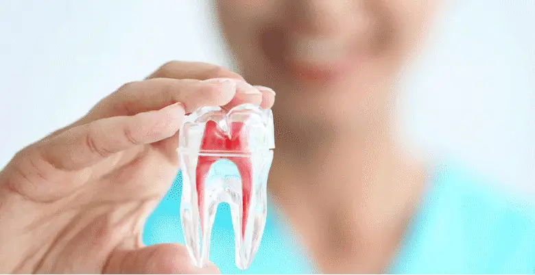 Symptoms of Root Canal: